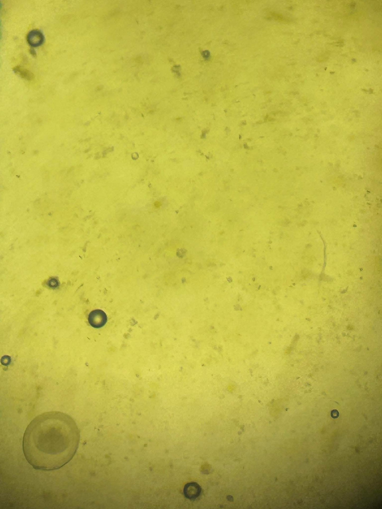 Faecal Egg Count