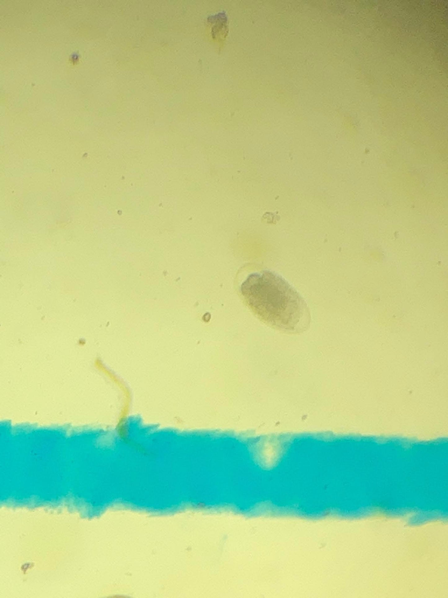 Faecal Egg Count